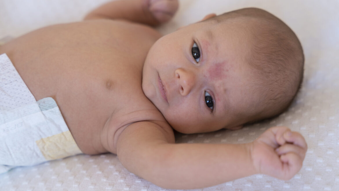 Baby Rashes Explained: Causes, Cures & Prevention Tips